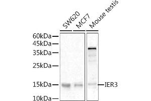 Western blot analysis of extracts of various cell lines, using IER3 antibody (ABIN6134174, ABIN6142158, ABIN6142159 and ABIN6224665) at 1:500 dilution. (IER3 anticorps  (C-Term))