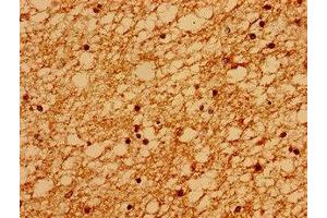 Immunohistochemistry of paraffin-embedded human brain tissue using ABIN7168566 at dilution of 1:100 (Sacsin anticorps  (AA 983-1150))