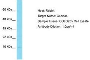 Image no. 1 for anti-Small Integral Membrane Protein 14 (SMIM14) (AA 12-61) antibody (ABIN6750772) (SMIM14 anticorps  (AA 12-61))