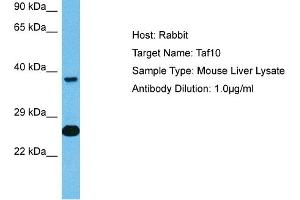 Host: Mouse Target Name: TAF10 Sample Tissue: Mouse Liver Antibody Dilution: 1ug/ml