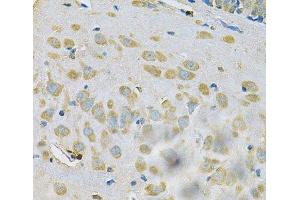 Immunohistochemistry of paraffin-embedded Rat brain using SAR1A Polyclonal Antibody at dilution of 1:100 (40x lens). (SAR1A anticorps)