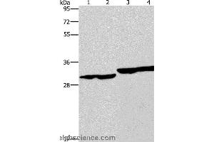 Western blot analysis of Human endometrial carcinoma and colon cancer tissue, human fetal liver tissue and PC3 cell, using DECR1 Polyclonal Antibody at dilution of 1:300 (DECR1 anticorps)