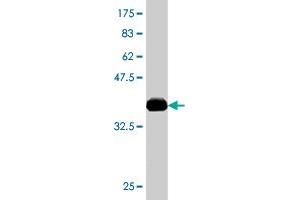 Western Blot detection against Immunogen (37. (ACAA2 anticorps  (AA 151-260))
