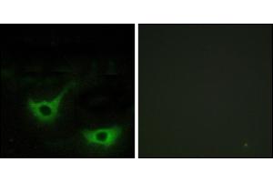 Immunofluorescence analysis of NIH/3T3 cells, using CALR antibody.