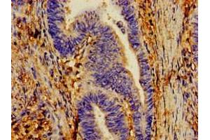 Immunohistochemistry of paraffin-embedded human lung tissue using ABIN7149202 at dilution of 1:100 (CYP1A1 anticorps  (AA 97-254))