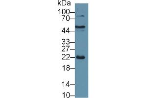 Detection of CRP in Porcine Liver lysate using Polyclonal Antibody to C Reactive Protein (CRP)