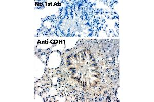 Immunohistochemistry (IHC) image for anti-Cadherin 1, Type 1, E-Cadherin (Epithelial) (CDH1) antibody (ABIN1440031)