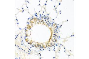 Immunohistochemistry of paraffin-embedded mouse lung using COQ7 antibody at dilution of 1:100 (x40 lens). (Coq7 anticorps)
