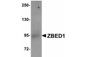 Image no. 1 for anti-Zinc Finger, BED-Type Containing 1 (ZBED1) (Internal Region) antibody (ABIN478064) (ZBED1 anticorps  (Internal Region))