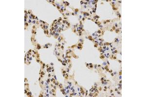 Immunohistochemistry (IHC) image for anti-Histone H3 (H3) (H3K36me2) antibody (ABIN3016036)