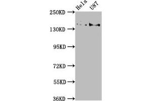 Western Blot Positive WB detected in: Hela whole cell lysate, U87 whole cell lysate All lanes: MYO5A antibody at 1:2000 Secondary Goat polyclonal to rabbit IgG at 1/50000 dilution Predicted band size: 216, 213, 219 kDa Observed band size: 216 kDa (MYO5A anticorps  (AA 1087-1220))