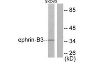 Western blot analysis of extracts from SKOV3 cells, using EFNB3 Antibody. (Ephrin B3 anticorps  (AA 221-270))
