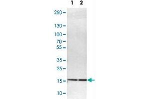 Western Blot analysis of Lane 1: NIH-3T3 cell lysate (mouse embryonic fibroblast cells) and Lane 2: NBT-II cell lysate (Wistar rat bladder tumor cells) with UBE2I polyclonal antibody . (UBE2I anticorps)