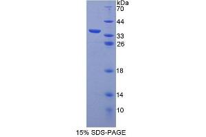 Image no. 1 for ATP-Binding Cassette, Sub-Family B (MDR/TAP), Member 7 (ABCB7) (AA 472-752) protein (T7 tag,His tag) (ABIN6239291)