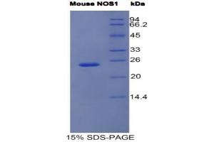 SDS-PAGE analysis of Mouse NOS1 Protein.