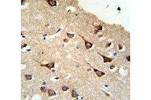 IHC analysis of FFPE human brain tissue stained with FYN antibody