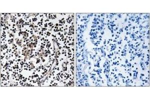 Immunohistochemistry analysis of paraffin-embedded human lymph node tissue, using SLC30A4 Antibody.