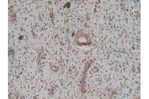 Detection of F2 in Rat Ovary Tissue using Polyclonal Antibody to Coagulation Factor II (F2)