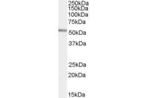 Image no. 1 for anti-WAS/WASL Interacting Protein Family, Member 1 (WIPF1) (C-Term) antibody (ABIN375118) (WIPF1 anticorps  (C-Term))