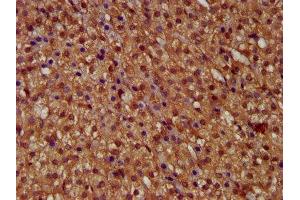 anti-Mitochondrial Calcium Uptake 1 (MICU1) (AA 55-191) antibody