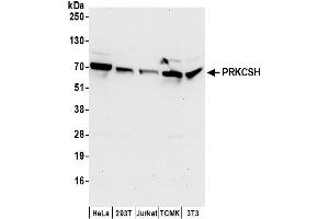 Western Blotting (WB) image for anti-Protein Kinase C Substrate 80K-H (PRKCSH) (AA 1-50) antibody (ABIN7450606)