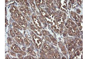 Image no. 11 for anti-Protein Disulfide Isomerase Family A, Member 3 (PDIA3) antibody (ABIN1498107)