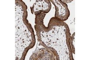 Immunohistochemical staining of human placenta with BNIP2 polyclonal antibody  shows strong cytoplasmic positivity in trophoblastic cells. (BNIP2 anticorps)