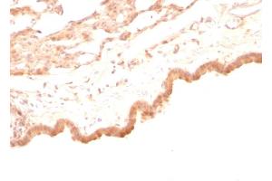 Formalin-fixed, paraffin-embedded Rat Lung stained with Glypican-3 Mouse Monoclonal Antibody (GPC3/863) (Glypican 3 anticorps)