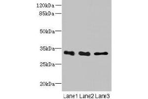 Western blot All lanes: EXOSC8 antibody at 4 μg/mL Lane 1: Mouse small intestine tissue Lane 2: Hela whole cell lysate Lane 3: K562 whole cell lysate Secondary Goat polyclonal to rabbit IgG at 1/10000 dilution Predicted band size: 31 kDa Observed band size: 31 kDa (EXOSC8 anticorps  (AA 2-276))
