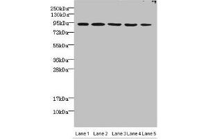 Western blot All lanes: THOC1 antibody at 3 μg/mL Lane 1: Jurkats whole cell lysate Lane 2: 293T whole cell lysate Lane 3: HepG2 whole cell lysate Lane 4: A549 whole cell lysate Lane 5: Mouse kidney tissue Secondary Goat polyclonal to rabbit IgG at 1/10000 dilution Predicted band size: 76, 44 kDa Observed band size: 76 kDa (THOC1 anticorps  (AA 428-657))