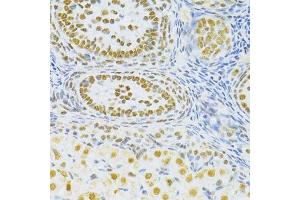Immunohistochemistry of paraffin-embedded rat ovary using SNRNP70 antibody.