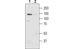 Western blot analysis of mouse liver membranes: - 1.