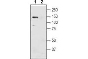 Western blot analysis of mouse liver membranes: - 1. (SLC4A4 anticorps  (2nd Extracellular Loop))