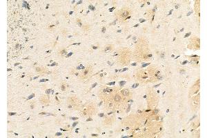 ABIN6261709 and ABIN6273117 at 1/100 staining Rat brain tissue by IHC-P. (FECH anticorps  (C-Term))