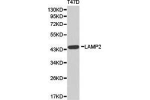 Western Blotting (WB) image for anti-Lysosomal-Associated Membrane Protein 2 (LAMP2) antibody (ABIN1873504) (LAMP2 anticorps)