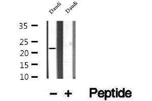 Western blot analysis of extracts of Daudi cells, using CHCHD4 antibody. (CHCHD4 anticorps  (N-Term))