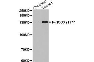 Western Blotting (WB) image for anti-Nitric Oxide Synthase 3 (Endothelial Cell) (NOS3) (pSer1177) antibody (ABIN1870485) (ENOS anticorps  (pSer1177))