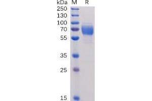 Human 2B4, hFc Tag on SDS-PAGE under reducing condition. (2B4 Protein (Fc Tag))