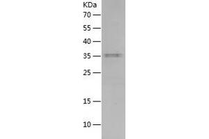 Western Blotting (WB) image for Interleukin 15 (IL15) (AA 49-162) protein (His-IF2DI Tag) (ABIN7123549)