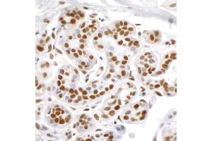 Immunohistochemistry (IHC) image for anti-Tripartite Motif Containing 28 (TRIM28) (AA 1-50) antibody (ABIN7455078) (KAP1 anticorps  (AA 1-50))