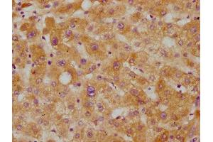 IHC image of ABIN7127423 diluted at 1:115 and staining in paraffin-embedded human liver tissue performed on a Leica BondTM system. (Recombinant CETP anticorps)