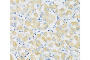 Immunohistochemistry of paraffin-embedded Human stomach using C1GALT1 Polyclonal Antibody at dilution of 1:100 (40x lens). (C1GALT1 anticorps)
