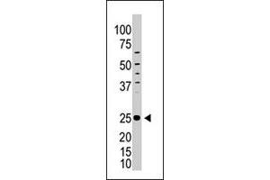 The ICOS polyclonal antibody  is used in Western blot to detect ICOS in HL-60 cell lysate.