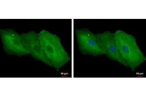 ICC/IF Image Galectin 1 antibody detects Galectin 1 protein at cytoplasm by immunofluorescent analysis.