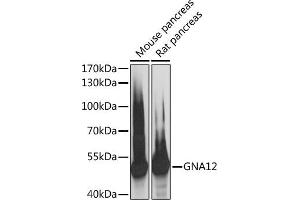 Western blot analysis of extracts of various cell lines, using GN antibody (ABIN6131706, ABIN6141192, ABIN6141193 and ABIN6217845) at 1:3000 dilution. (GNA12 anticorps  (AA 1-200))