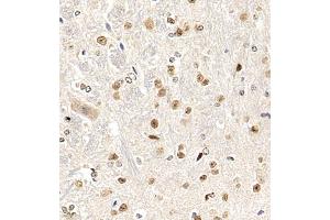 Immunohistochemistry of paraffin embedded mouse spinal cord using HRP3 (ABIN7074198) at dilution of 1:2000 (400x lens)