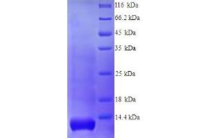 SDS-PAGE (SDS) image for Glycophorin A (GYPA) (AA 20-91), (Extracellular) protein (His tag) (ABIN5713492)