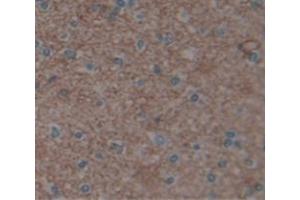 IHC-P analysis of Human Tissue, with DAB staining. (UACA anticorps  (AA 29-209))