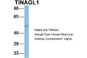 Host: Rabbit Target Name: TINAGL1 Sample Type: Human Fetal Liver Antibody Dilution: 1.