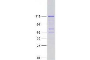 Validation with Western Blot